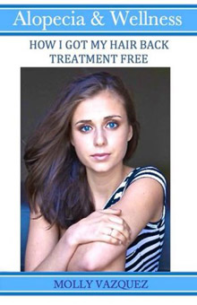 Alopecia & Wellness - How I Got My Hair Back Treatment Free - Molly Vazquez