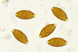 Waarom vormen parasieten een gevaar voor de gezondheid?