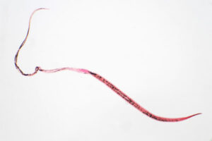 Waarom vormen parasieten een gevaar voor de gezondheid?